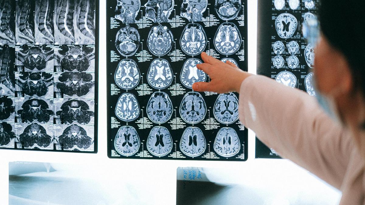Ғалымдар 50 жастан кейін мида қандай жасырын өзгерістер басталатынын анықтады