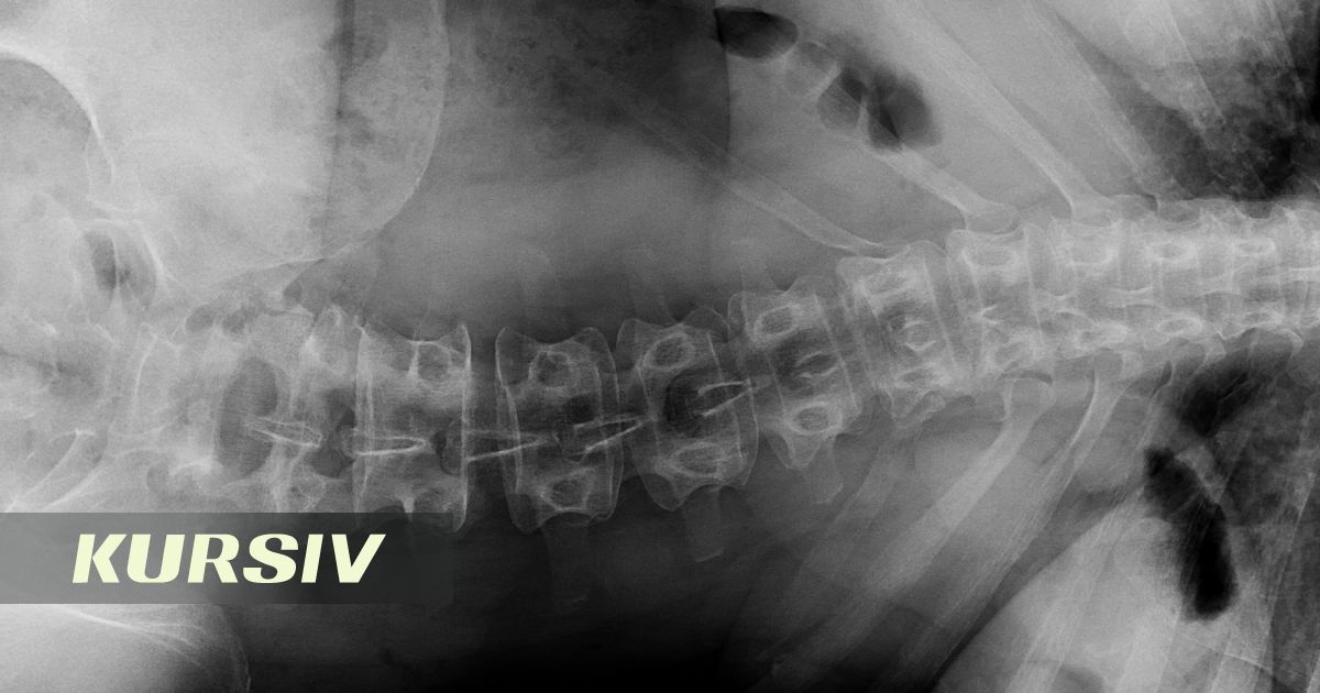 Қазақстандық хирургтар Тәжікстанда омыртқаға бірегей ота жасады