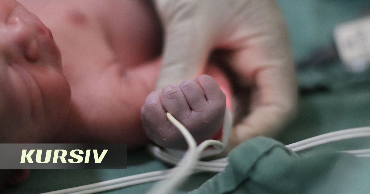 Алматыдағы дәрігерлер тамыз айында туған екі үшемді емдеп жатыр